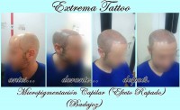 /album/micropigmentacion/tricopigmentacion-capilar-badajoz-jpg/